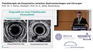 Fisteltherapie als Kooperation zwischen Gastroenterologen und Chirurgen [upl. by Ketchum]