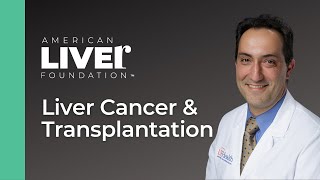 Liver Cancer amp Transplantation [upl. by Vivia]