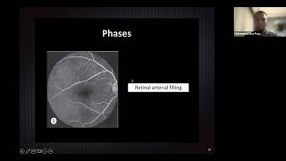 Retinal Vascularization amp FFA Mohammad Eko Prayogo [upl. by Ainavi]