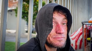 Los Angeles Homeless Mans Isolation Is Causing Mental Health Challenges [upl. by Eneleahs720]