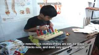 Cell Therapy treatment for autism by dr alok sharma mumbai india [upl. by Neellok]