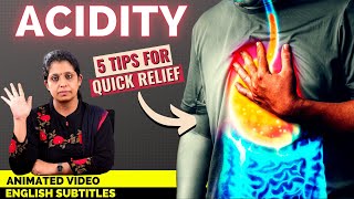 Animation How to treat Acid Reflux  நெஞ்செரிச்சல் குணமாக இதை செய்யுங்கள் [upl. by Stoddart]