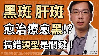 黑斑、肝斑，為何愈治療愈黑？哪種肝斑適合打雷射？分類錯誤是關鍵，皮膚科林政賢醫師教你一招判斷黑斑分類。 [upl. by Imiaj]