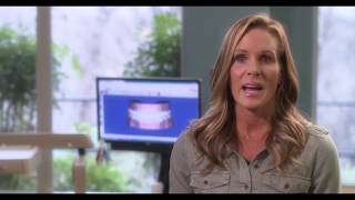 SureSmile® Aligner Patient Testimonial  Christa [upl. by Htes]