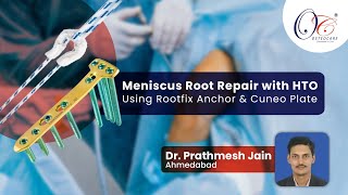 Meniscus Root Repair with HTO  ReLive Surgery  Surgical Technique Video [upl. by Eirak]