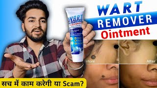 Wart Remover Cream Review  Wart Remover Ointment [upl. by Libbna]