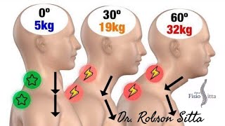 Exercício Cervical Retração Sentado MÉTODO McKENZIE MDT Clínica Fisioterapia Dr Robson Sitta [upl. by Airtal978]