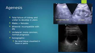 Renal Pathology [upl. by Lamp758]