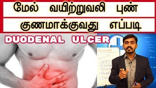 மேல் வயிற்றுவலி அல்லது முன்சிறுகுடல் புண் குணமாக்குவது எப்படி l Duodenal ulcer Cure Drsj [upl. by Eesyak]