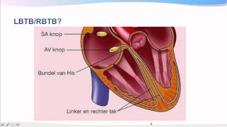 Introductiecursus ECG interpretatie [upl. by Yralih822]