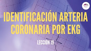 19 IDENTIFICACIÓN ARTERIA CORONARIA POR EKG ELECTROCARDIOGRAFÍA [upl. by Sholley]