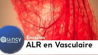 Emission ALR et chirurgie vasculaire 2019 [upl. by Ogawa]