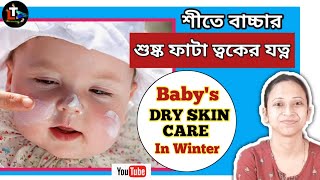 Babys Winter Dry Skin Care Tips  site bachar toker jotno  Winter Baby Care  Baby Skin Care [upl. by Nohtanoj]