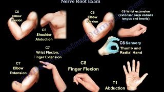 Cervical Spine Nerve Root Exam  Everything You Need To Know  Dr Nabil Ebraheim [upl. by Naloj]