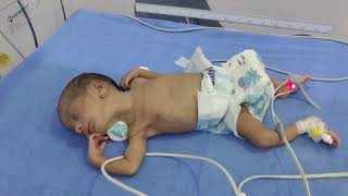 Today I went to the new hospital for duty  pray for this child [upl. by Ycat]