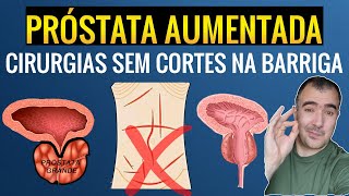 PRÓSTATA AUMENTADA quais cirurgias que não têm cortes na sua barriga [upl. by Ahtekal]