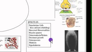 Calcium Homeostasis Part 2 [upl. by Tenahs]