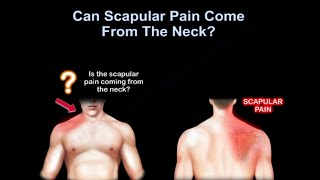 Neck pain or shoulder pain WHY IT HURTS [upl. by Dolf]