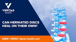 Can Herniated Discs Heal on Their Own [upl. by Yelruc681]