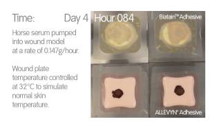 Foam Dressing Comparison  ALLEVYN◊ Adhesive v BiatainTM Adhesive [upl. by Animas]