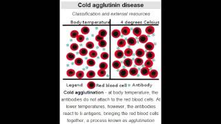 Cold Agglutinin Disease autoimmune hemolytic anemia Mycoplasma Pneumoniae amp Mononucleosis [upl. by Eitak]