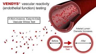 VENDYS  Endothelial Function Measurement Explained [upl. by Ynatterb726]