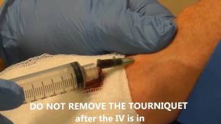 IV Insertion with Lab Draw [upl. by Barbe]