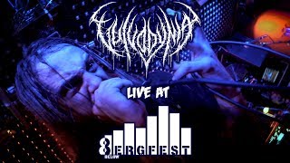 Vulvodynia  Live at 8Below Bergfest  FULL SHOW [upl. by Saunders]