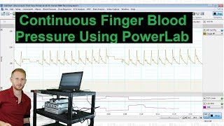 Continuous Finger Blood Pressure in PowerLab [upl. by Yelloh905]