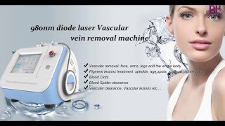 980nm diode laser for vascular removal [upl. by Weylin466]