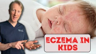 How to treat Eczema in Babies amp Children Dermatology Doctor explains [upl. by Xenophon]