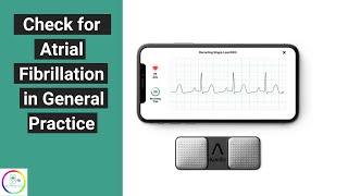 Easy way to check for atrial fibrillation in General Practice  with Alivekor Kardia [upl. by Asena]