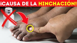 10 MANERAS MILAGROSAS de ELIMINAR LA HINCHAZÓN en TOBILLOS Y PIES [upl. by Henrik]