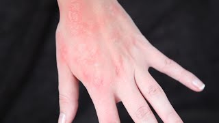 Rash  SFX makeup Tutorial [upl. by Harvison274]