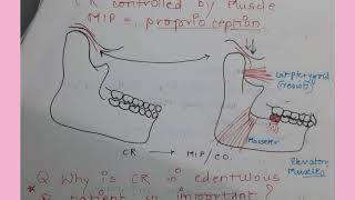 Centric jaw relation in Complete Denture NOTES Methods to record Significance [upl. by Ahsilak817]