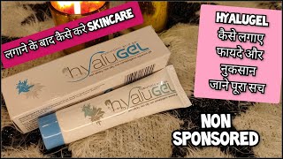 Hyalugel Review  फायदे और नुकसान  Hyalugel hyaluronic acid gel uses  Shruti Mishra [upl. by Herm498]