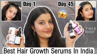 Hair Growth Serums That Actually Work  Best In India [upl. by Forras]