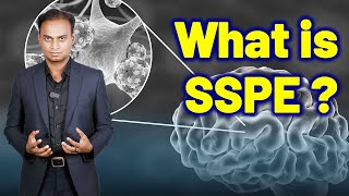 What is SSPE or Subacute Sclerosing Panencephalitis or Dowson Disease  Homeopathy Treatment amp Cure [upl. by Negriv243]