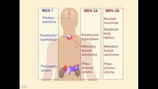 Endocrinology Review Questions  CRASH Medical Review Series [upl. by Sacram]