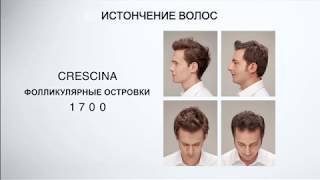 Crescina HFI Hair Follicular Islands  интенсивный курс для возобновления роста волос [upl. by Anelhtac]