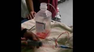 Chest Tube Aspiration [upl. by Hales885]