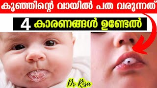 Baby Care Tips Malayalam Foamy Saliva in Babies  കുഞ്ഞിന്റെ വായിൽ പത വരുന്നത് [upl. by Okimuk]