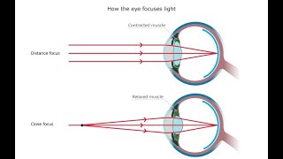 Accommodation amp eye defects grade 12 life sciences  ThunderEDUC  MSAIDI [upl. by Atsahc]