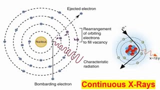 Continuous X Rays Explained with Animation  Understand the Basics [upl. by Pantheas]