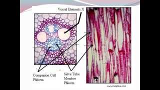 IGCSE 27 Translocation [upl. by Barta580]