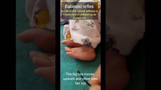 Babinski Reflex in newborn [upl. by Eckhardt822]