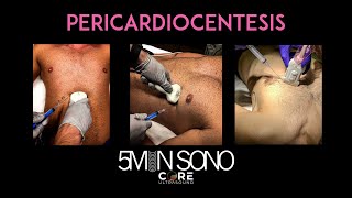 5 Minute Sono  Pericardiocentesis [upl. by Ailecec]