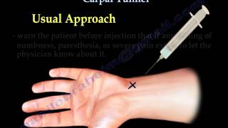 Carpal Tunnel Injection  Everything You Need To Know  Dr Nabil Ebraheim [upl. by Stephine]