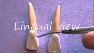 Maxillary Lateral Incisor Anatomy [upl. by Pylle]