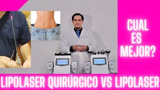 Lipolaser Quirúrgico vs Lipolaser Frío diferencias [upl. by Mellicent]